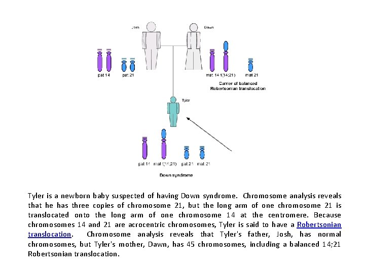 Tyler is a newborn baby suspected of having Down syndrome. Chromosome analysis reveals that
