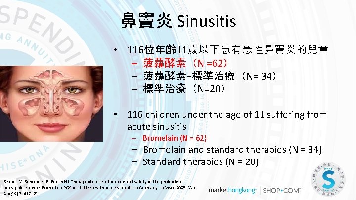 鼻竇炎 Sinusitis • 116位年齡 11歲以下患有急性鼻竇炎的兒童 – 菠蘿酵素（N =62） – 菠蘿酵素+標準治療（N= 34） – 標準治療（N=20） •