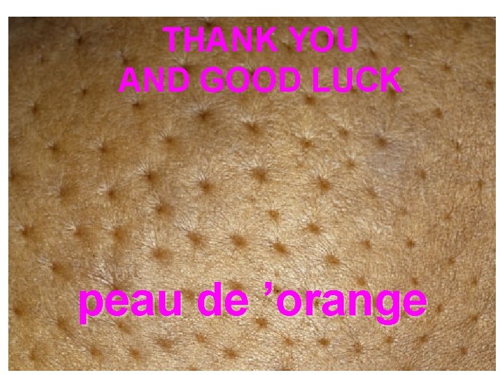 GOODTHANK LUCK YOU AND GOOD LUCK peau de ’orange 