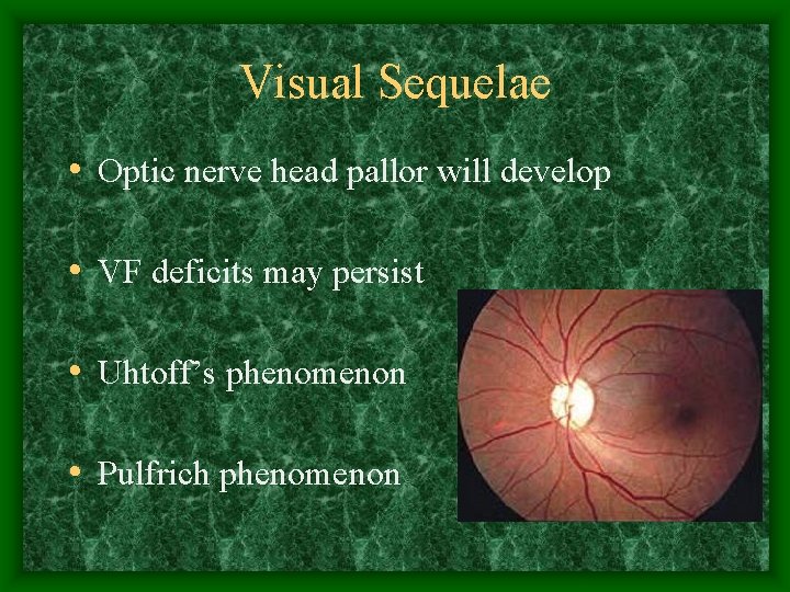 Visual Sequelae • Optic nerve head pallor will develop • VF deficits may persist