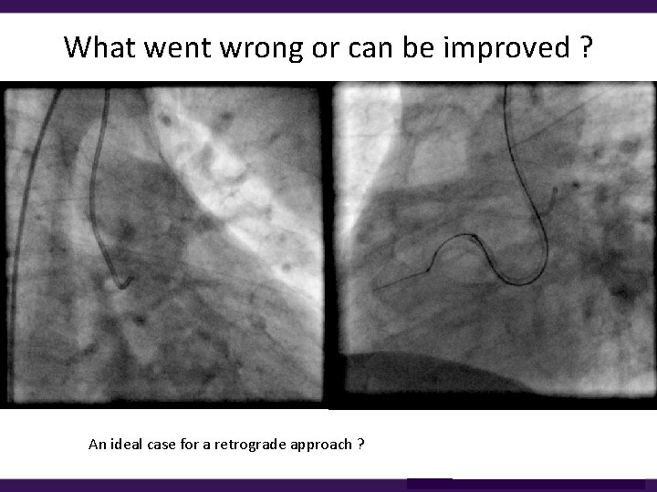 What went wrong or can be improved ? An ideal case for a retrograde