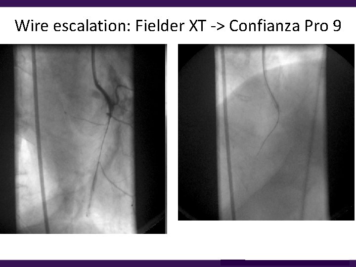 Wire escalation: Fielder XT -> Confianza Pro 9 