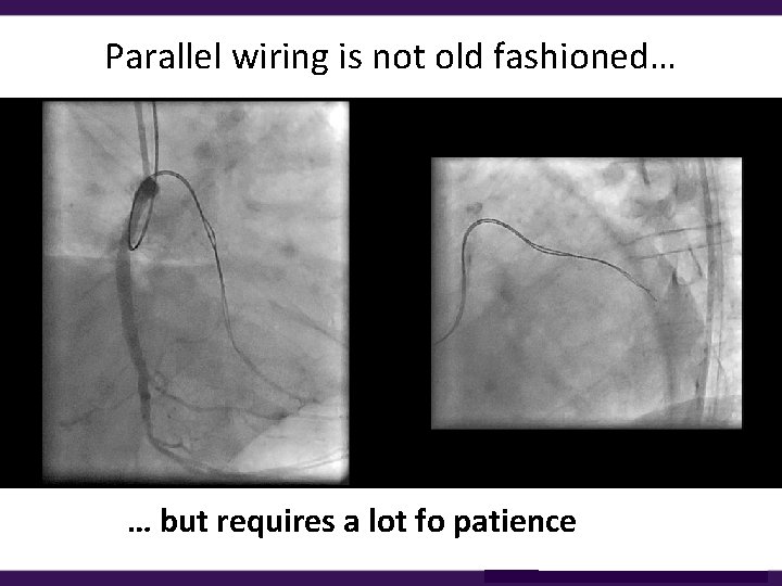Parallel wiring is not old fashioned… … but requires a lot fo patience 