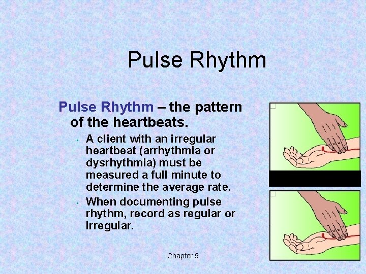Pulse Rhythm – the pattern of the heartbeats. • • A client with an Pulse Rhythm – the pattern of the heartbeats. • • A client with an