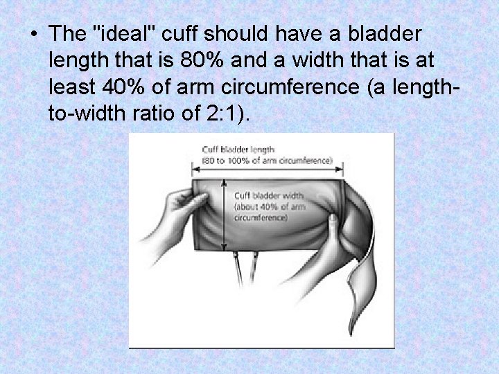 • The "ideal" cuff should have a bladder length that is 80% and • The "ideal" cuff should have a bladder length that is 80% and