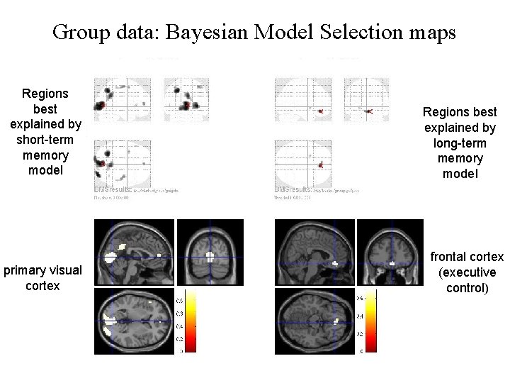 Group data: Bayesian Model Selection maps Regions best explained by short-term memory model primary