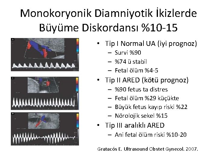 Monokoryonik Diamniyotik İkizlerde Büyüme Diskordansı %10‐ 15 • Tip I Normal UA (iyi prognoz)