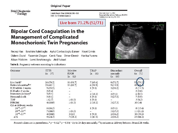 Live born 73. 2% (52/71) 