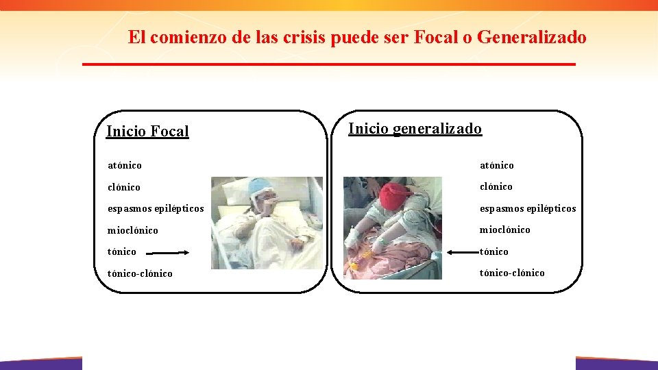 El comienzo de las crisis puede ser Focal o Generalizado Inicio Focal Inicio generalizado