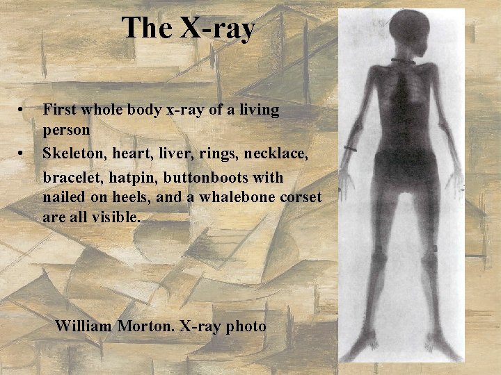 The X-ray • • First whole body x-ray of a living person Skeleton, heart,