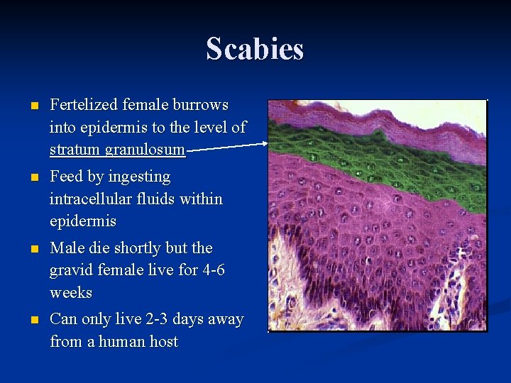 Scabies n Fertelized female burrows into epidermis to the level of stratum granulosum n