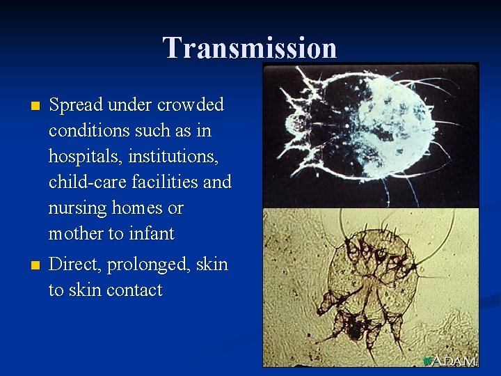 Transmission n Spread under crowded conditions such as in hospitals, institutions, child-care facilities and