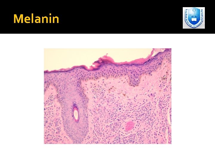 Melanin 