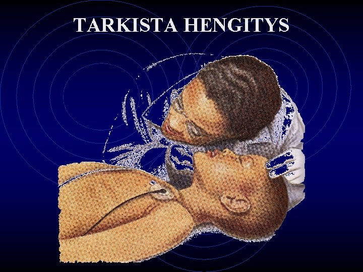 TARKISTA HENGITYS 