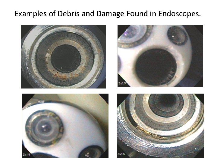 Examples of Debris and Damage Found in Endoscopes. 