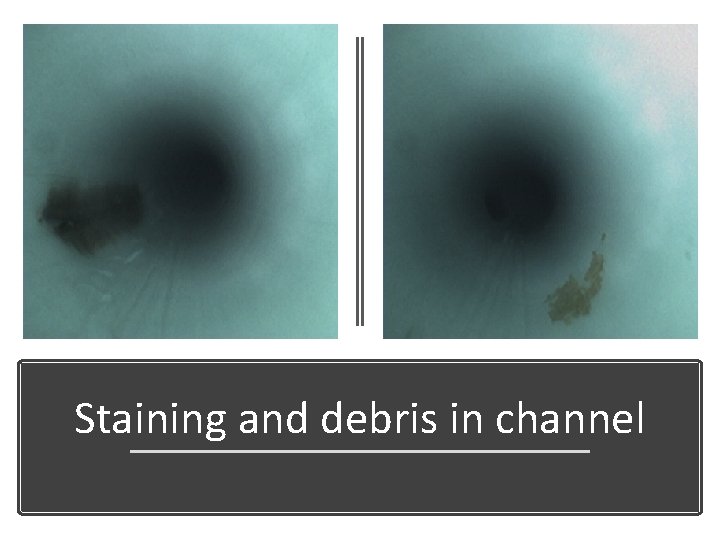 Staining and debris in channel 