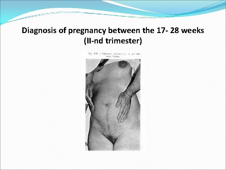 Diagnosis of pregnancy between the 17 - 28 weeks (II-nd trimester) 