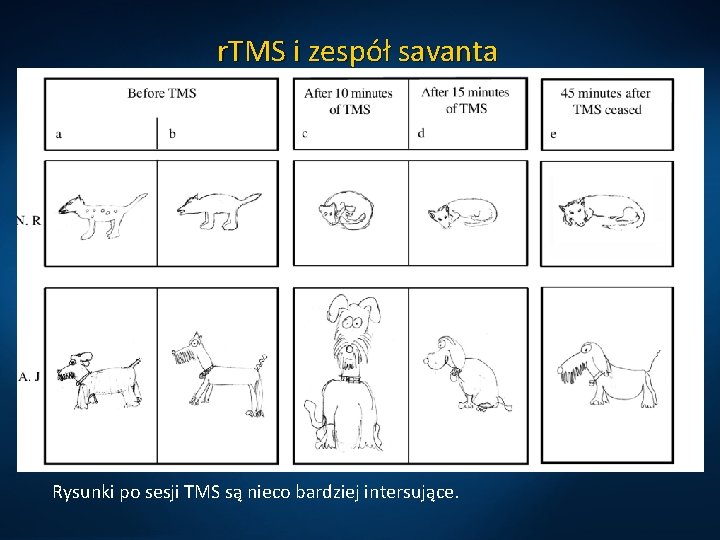 r. TMS i zespół savanta Rysunki po sesji TMS są nieco bardziej intersujące. 
