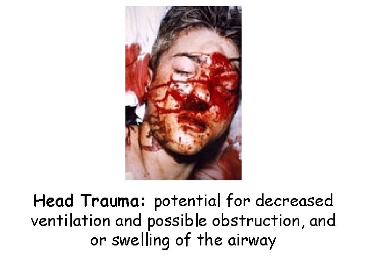 Head Trauma: potential for decreased ventilation and possible obstruction, and or swelling of the