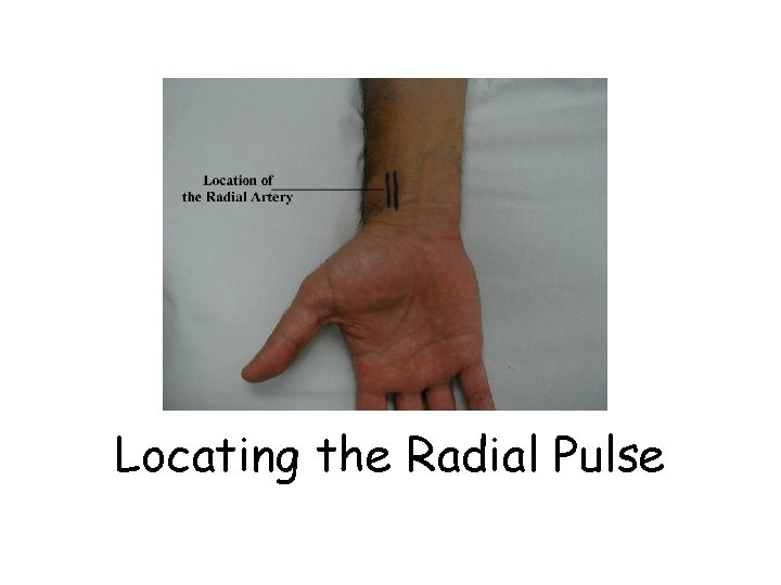 Locating the Radial Pulse 