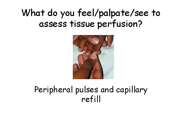 What do you feel/palpate/see to assess tissue perfusion? Peripheral pulses and capillary refill 