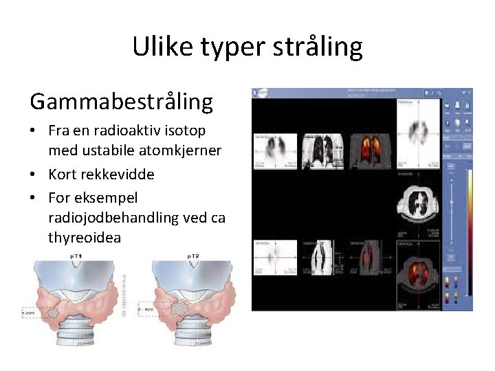 Ulike typer stråling Gammabestråling • Fra en radioaktiv isotop med ustabile atomkjerner • Kort