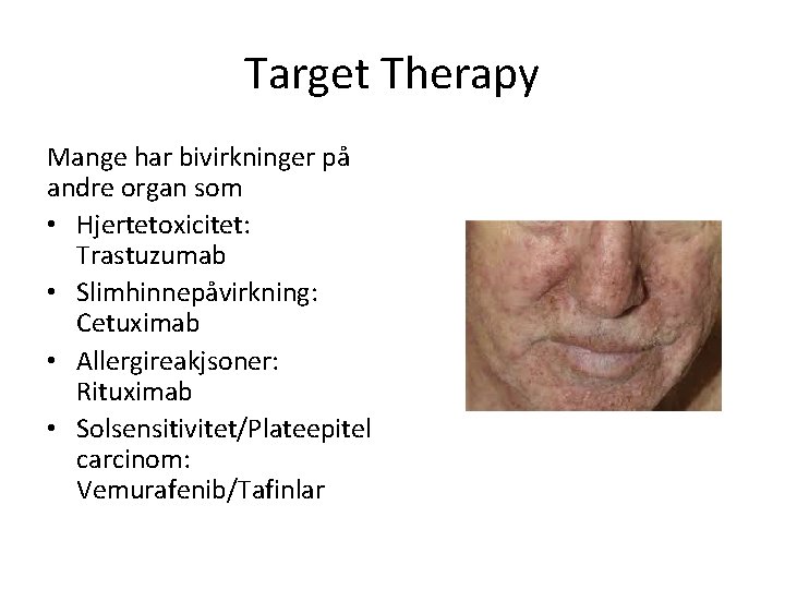 Target Therapy Mange har bivirkninger på andre organ som • Hjertetoxicitet: Trastuzumab • Slimhinnepåvirkning: