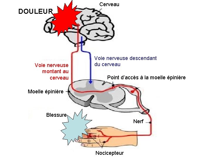 Cerveau DOULEUR Voie nerveuse montant au cerveau Voie nerveuse descendant du cerveau Point d’accès