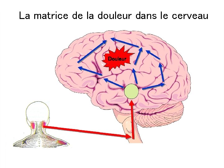 La matrice de la douleur dans le cerveau Douleur 