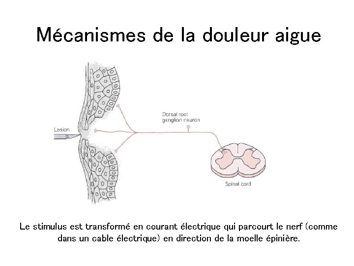 Mécanismes de la douleur aigue Le stimulus est transformé en courant électrique qui parcourt