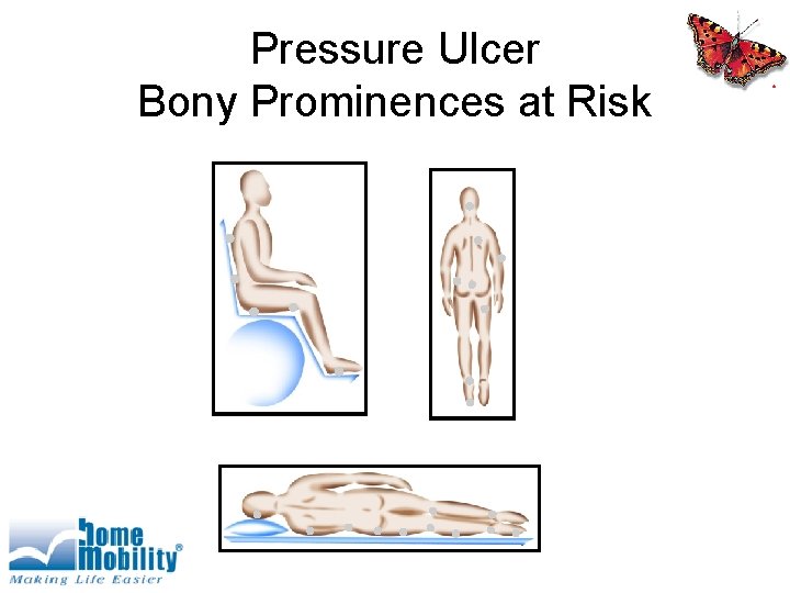 Pressure Ulcer Bony Prominences at Risk 