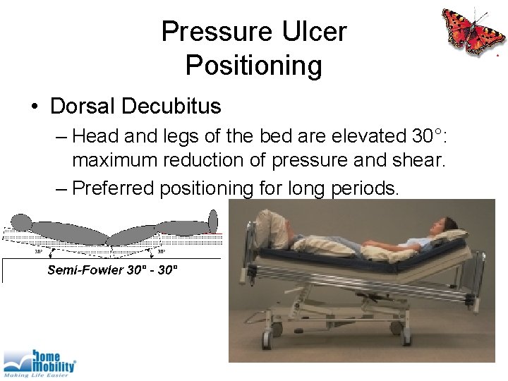 Pressure Ulcer Positioning • Dorsal Decubitus – Head and legs of the bed are