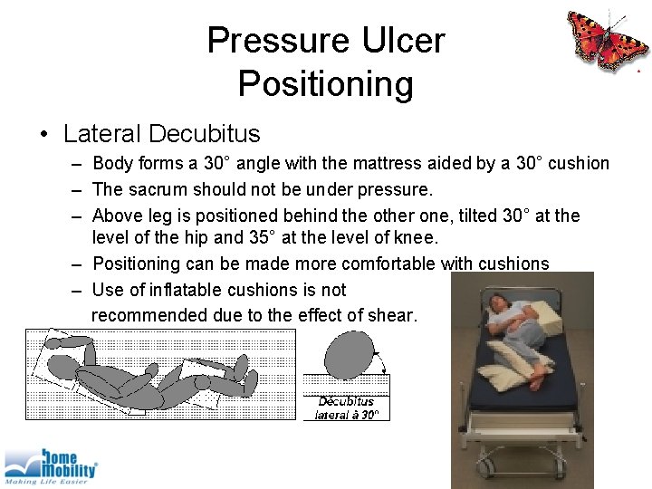 Pressure Ulcer Positioning • Lateral Decubitus – Body forms a 30° angle with the