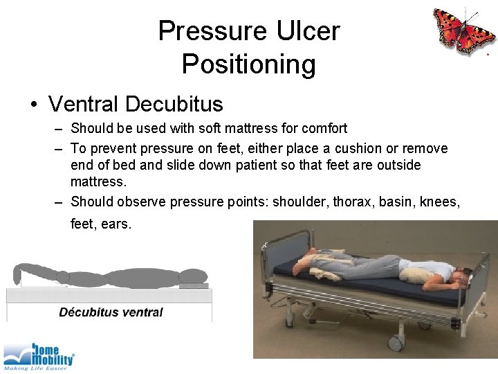 Pressure Ulcer Positioning • Ventral Decubitus – Should be used with soft mattress for