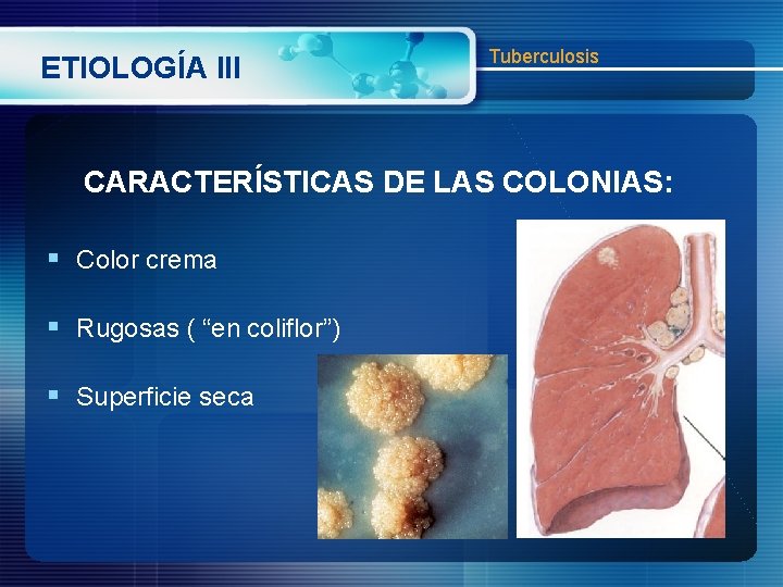 ETIOLOGÍA III Tuberculosis CARACTERÍSTICAS DE LAS COLONIAS: § Color crema § Rugosas ( “en