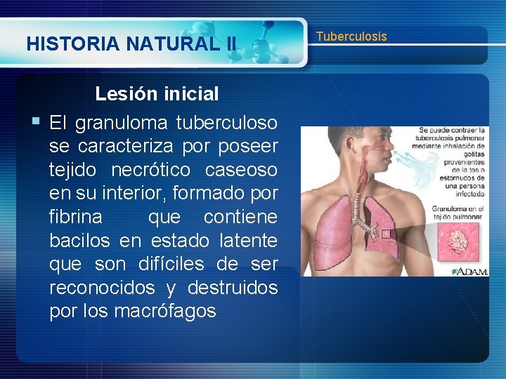 HISTORIA NATURAL II Lesión inicial § El granuloma tuberculoso se caracteriza por poseer tejido