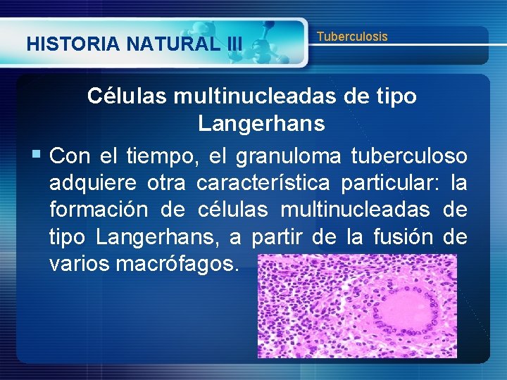 HISTORIA NATURAL III Tuberculosis Células multinucleadas de tipo Langerhans § Con el tiempo, el