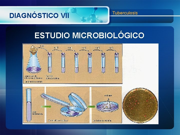 DIAGNÓSTICO VII Tuberculosis ESTUDIO MICROBIOLÓGICO 