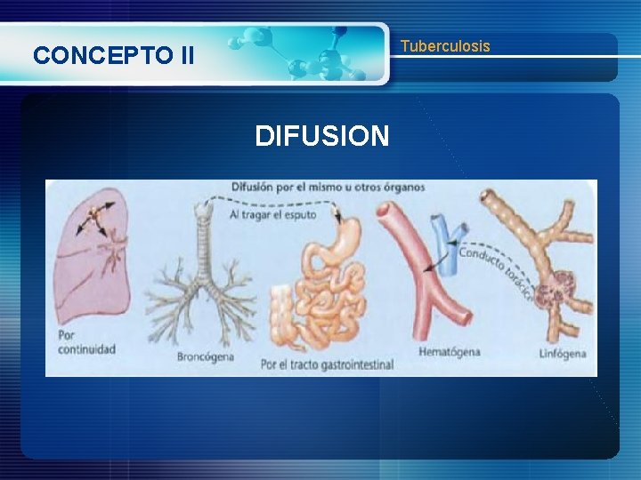 Tuberculosis CONCEPTO II DIFUSION 