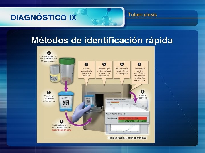 DIAGNÓSTICO IX Tuberculosis Métodos de identificación rápida 