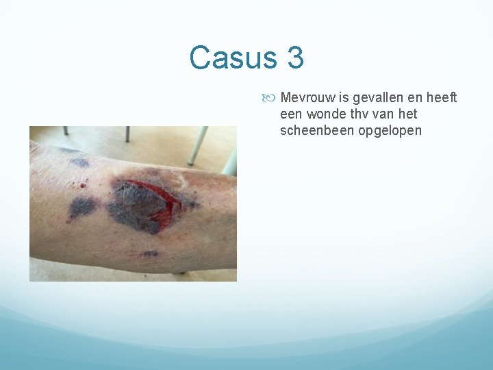 Casus 3 Mevrouw is gevallen en heeft een wonde thv van het scheenbeen opgelopen