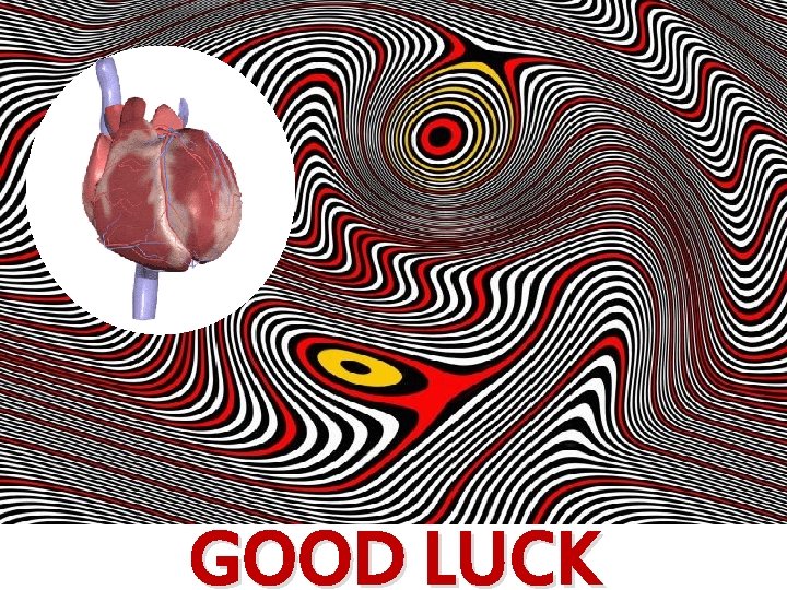 GOOD LUCK 