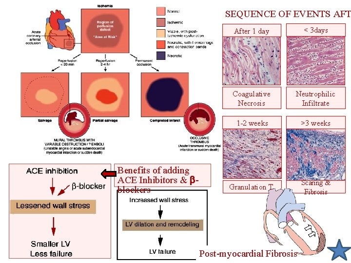 SEQUENCE OF EVENTS AFT Benefits of adding ACE Inhibitors & blockers After 1 day