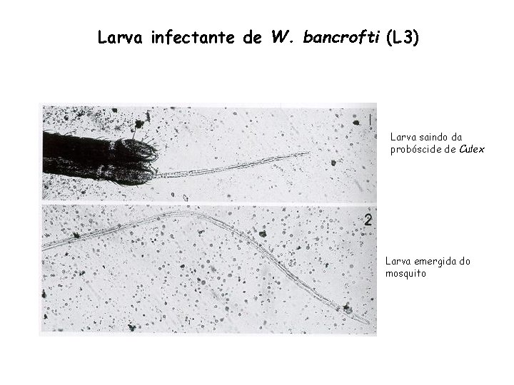 Larva infectante de W. bancrofti (L 3) Larva saindo da probóscide de Culex Larva