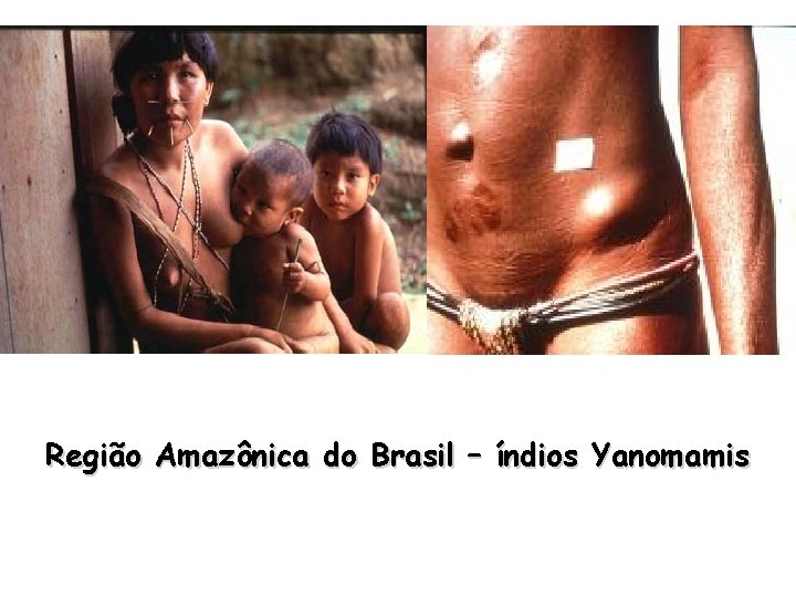 Região Amazônica do Brasil – índios Yanomamis 