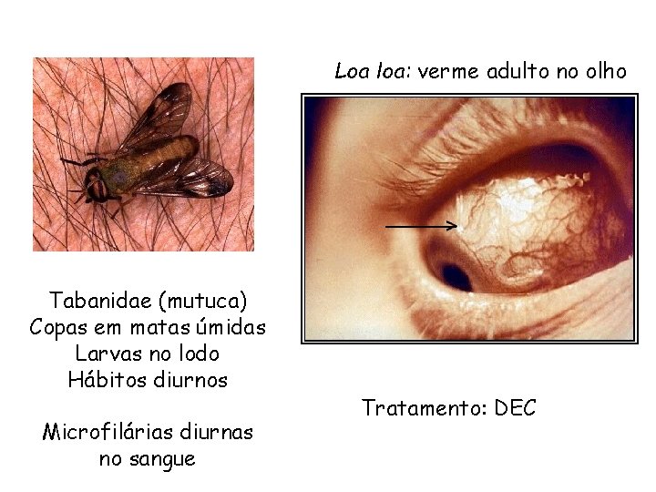 Loa loa: verme adulto no olho Tabanidae (mutuca) Copas em matas úmidas Larvas no