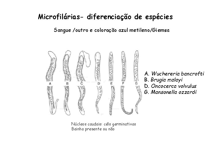 Microfilárias- diferenciação de espécies Sangue /outro e coloração azul metileno/Giemsa A. Wuchereria bancrofti B.