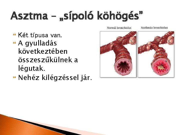 Asztma – „sípoló köhögés” Két típusa van. A gyulladás következtében összeszűkülnek a légutak. Nehéz