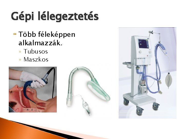 Gépi lélegeztetés Több féleképpen alkalmazzák. ◦ Tubusos ◦ Maszkos 