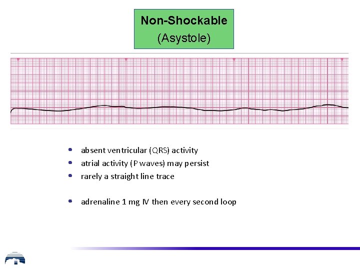 Non-Shockable (Asystole) • absent ventricular (QRS) activity • atrial activity (P waves) may persist